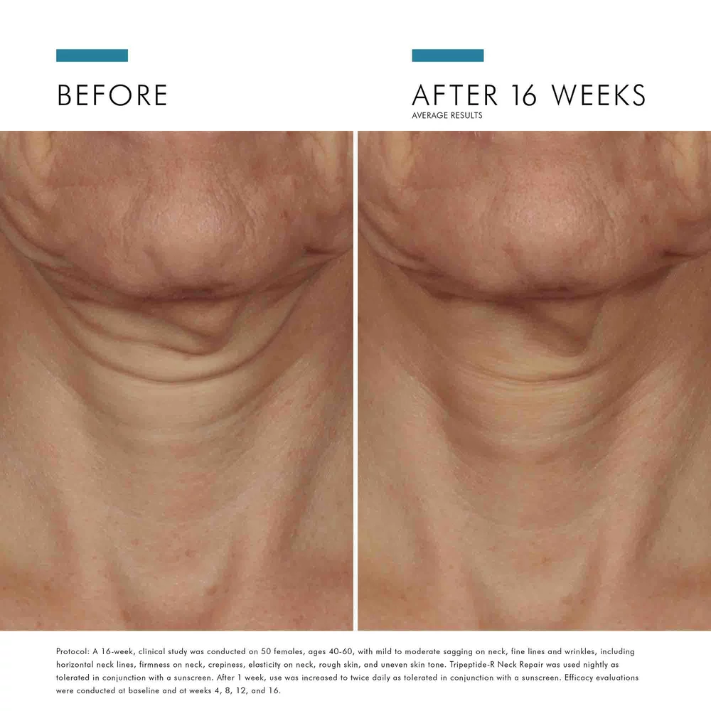 Tripeptide-R Neck Repair - View 6