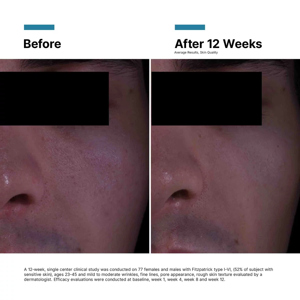 P-TIOX Anti-Wrinkle Cream - View 5