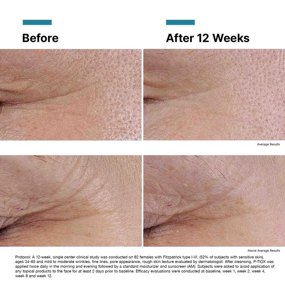 P-TIOX Anti-Wrinkle Serum - View 11