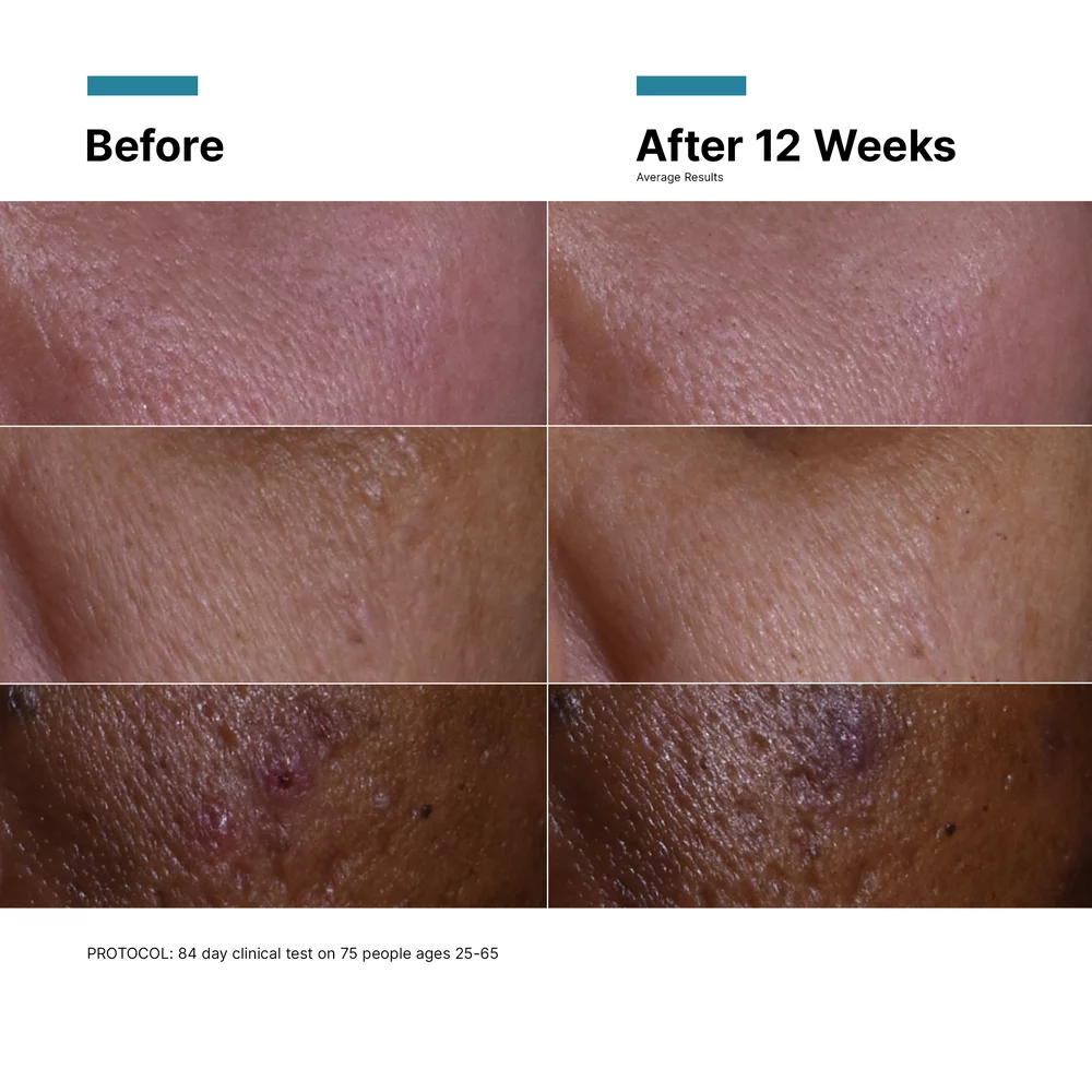 C E Ferulic with 15% L-Ascorbic Acid - View 13