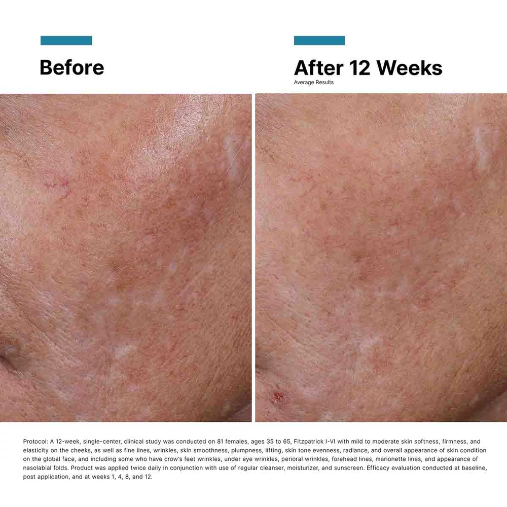 Hyaluronic Acid Intensifier Multi-Glycan - View 11