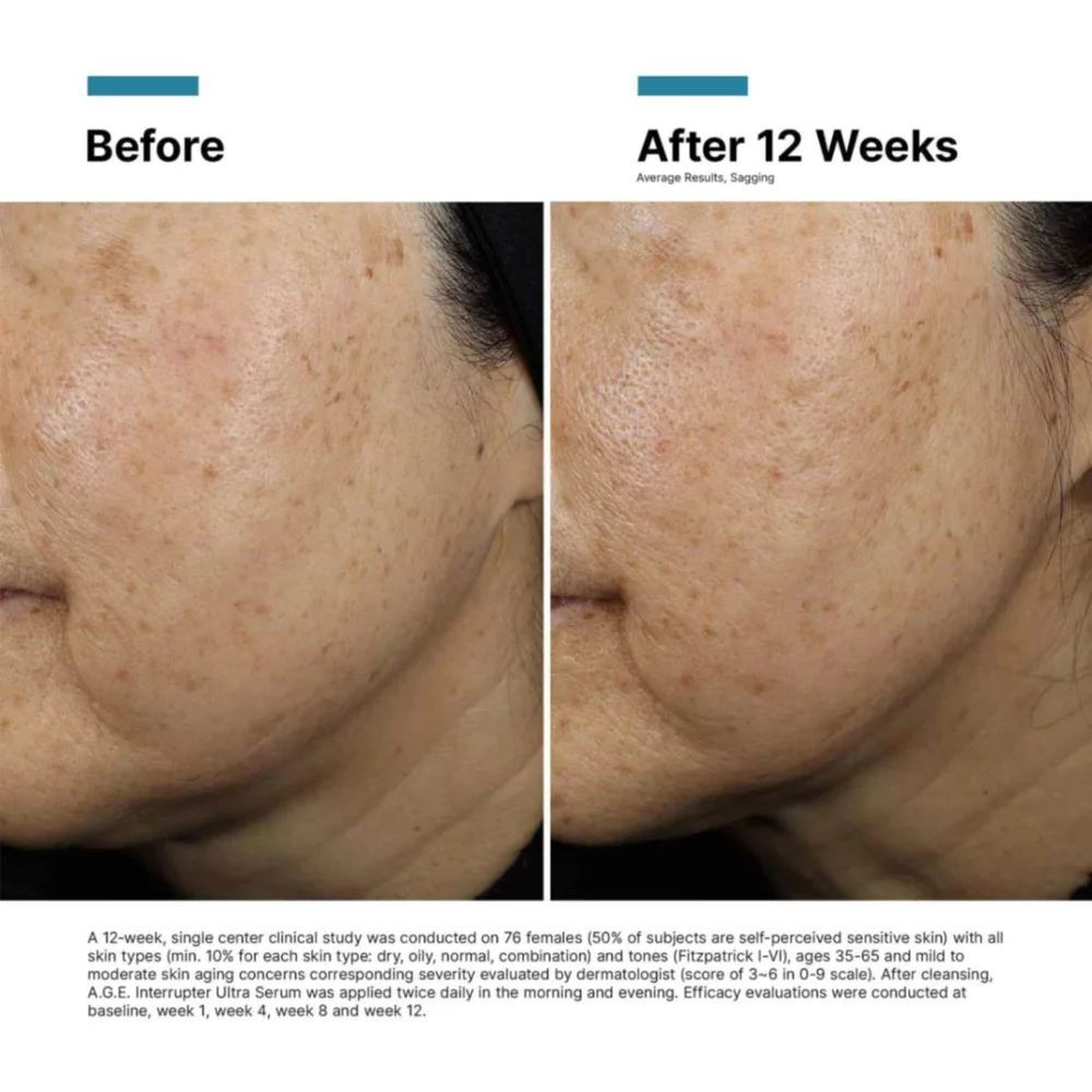 A.G.E. Interrupter Ultra Serum - View 13