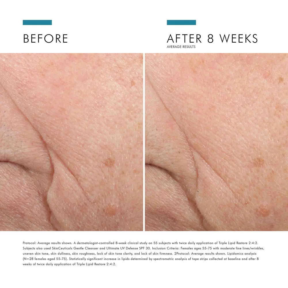 Triple Lipid Restore 2:4:2 - View 12