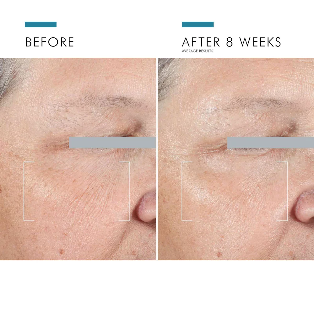A.G.E. Advanced Eye Cream for Dark Circles - View 7