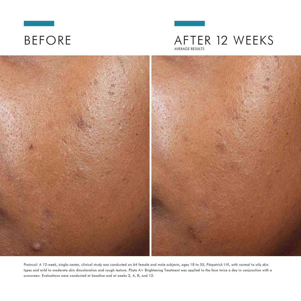 Phyto A+ Brightening Treatment - View 7