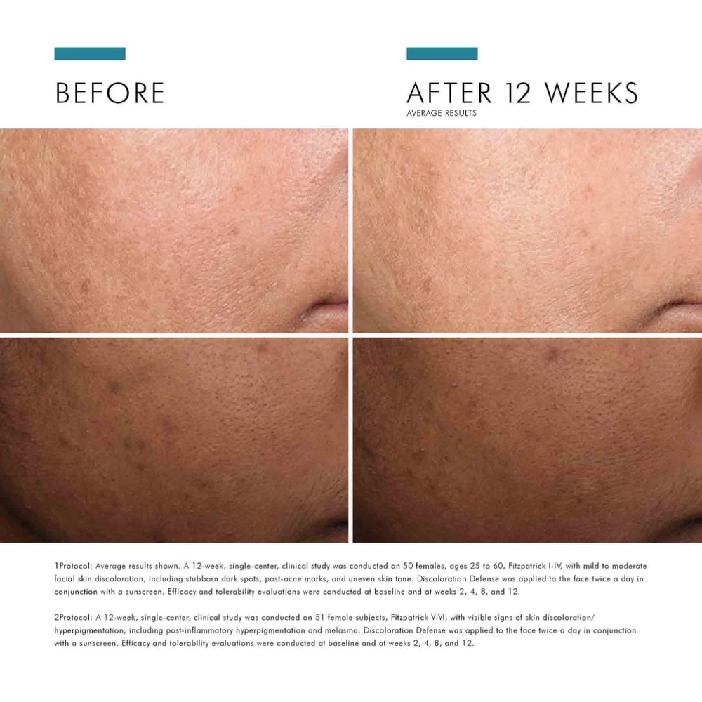 Discoloration Defense - View 7